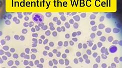 indentify the WBC Cell #viralshort #wbc #whitebloodcells #science #medical