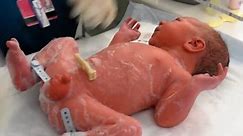 Cute baby just new born baby #newborn #baby #cutebaby #baby #injection #hospital #manishanursingwork