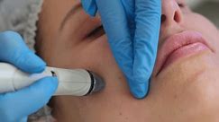Professional moisturizing and rejuvenating hardware procedure. Hydrafacial massage process. Close-up shot of a young woman receiving microdermabrasion therapy at beauty spa.