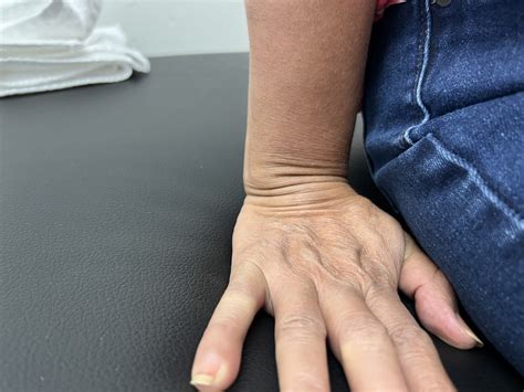 How To Help Wrist Pain