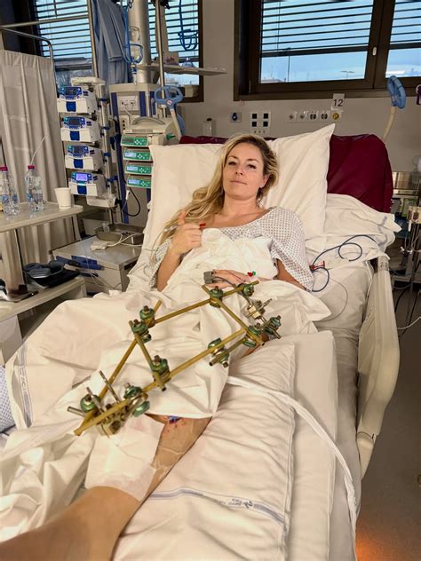 Lindsey Vonn’s Torn ACL and Near-Amputation: A Complete Timeline of Her ...