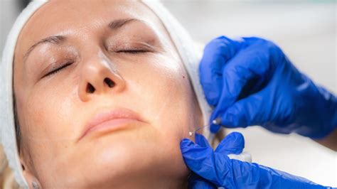 Facial Contouring Techniques - Surgical vs. Non-Surgical Approaches | Estherian Clinic
