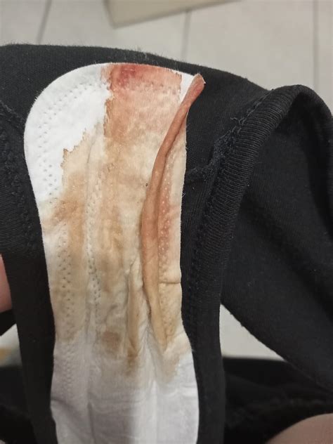 ovulation bleeding? is this normal? I've had some very minor cramping ...