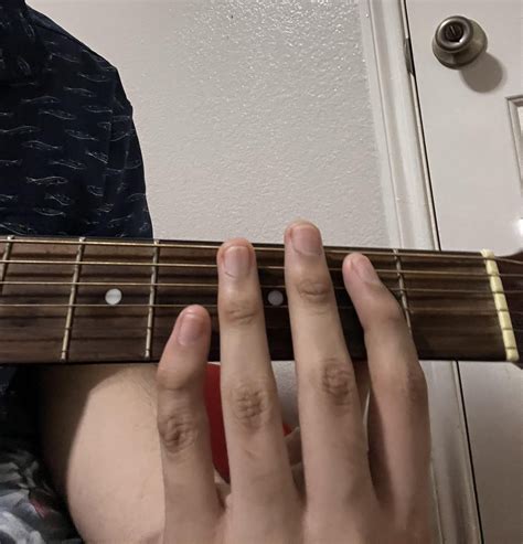 I have a crooked pinky finger aka Clinodactyly. Been playing basic Chords and scales for a few ...