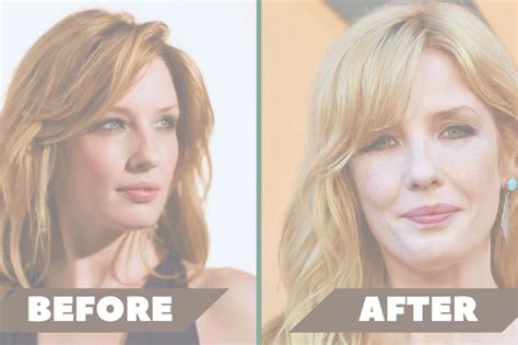 Kelly Reilly Lip Surgery: Fact vs. Fiction with Photos - Usacharged