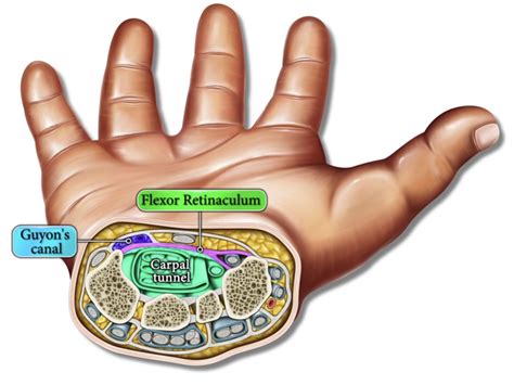 Flexor Retinaculum