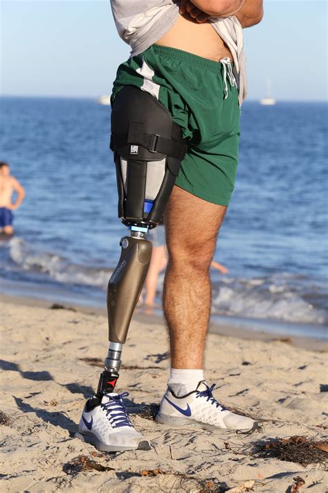 Transtibial prosthesis prosthetic orthotic associates – Artofit