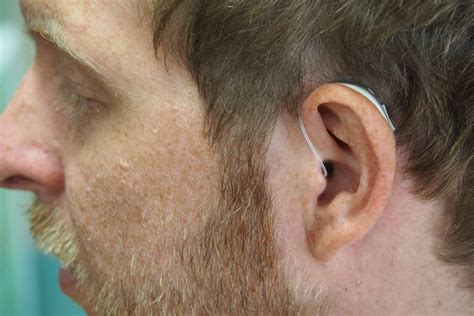Hearing Aid Fitting Process | Professional Guidance | Horizon Hearing Centres