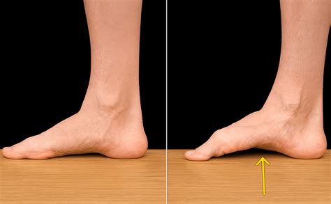 7 Best Exercises for Flat Feet: Strengthen Your Arches at Home – Posturepro