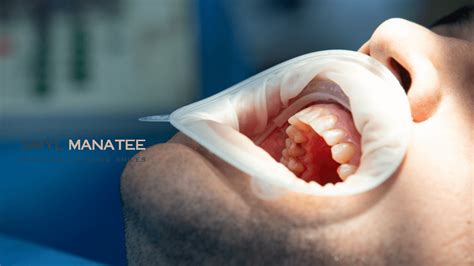 How Much Does a Cavity Filling Cost?