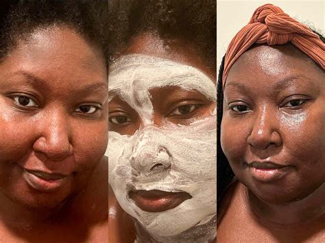 The 15 Best Benzoyl Peroxide Products, Tested and Reviewed