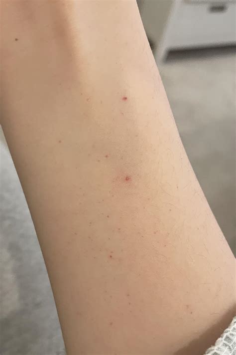 What are these small red bumps on my arm? They just randomly showed up today. They aren’t itchy ...