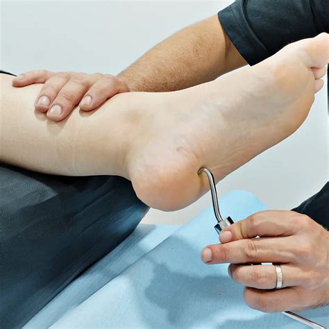 ¿Qué es el Espolón calcáneo? ¿Por qué aparece y por qué duele?