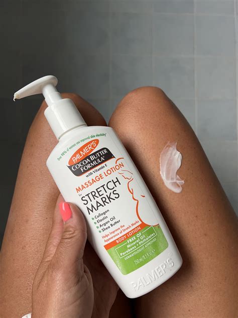 The 6 best stretch mark creams of 2025