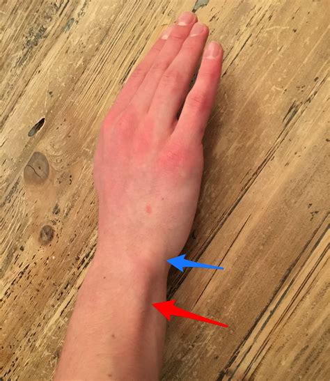 Young Athlete Center: Wrist Pain in Baseball