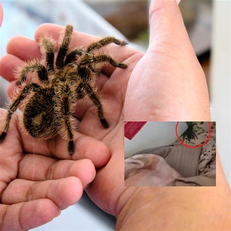 Danger Of Tarantula Bites And Scorpion Stings Poison, 59% OFF