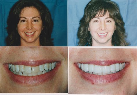 Dental Professionals Of Lincoln Park at Anna Beyers blog