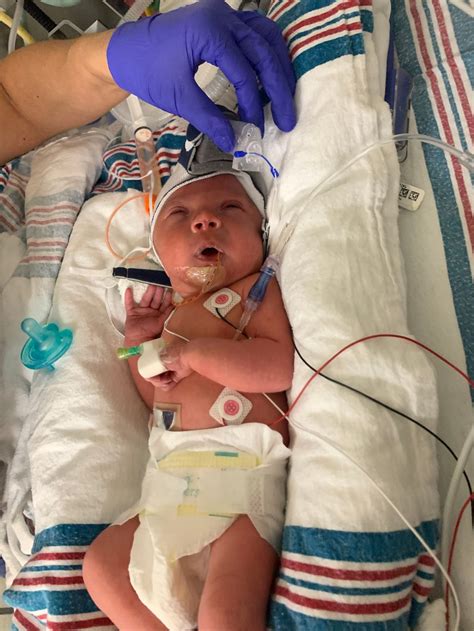 Born At 34 Weeks Pregnant
