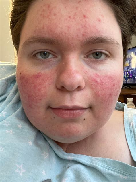 is this normal? I’ve had this weird thing that happens to me all the time basically my arm goes ...