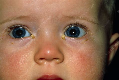 Newborn Baby Eyes Pupils at Todd Briggs blog