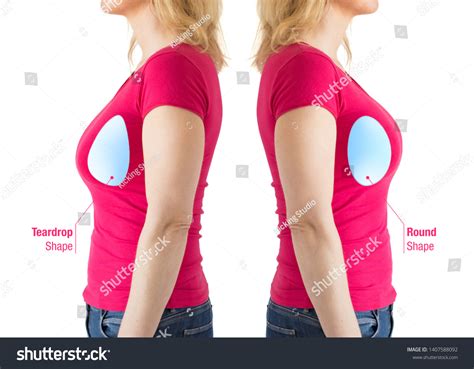 Woman Illustrations Round Teardrop Shaped Breast Stock Photo 1407588092 | Shutterstock