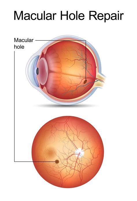 Macula