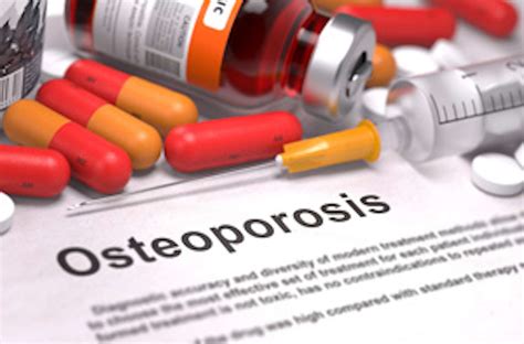How Conventional Osteoporosis Treatments Fall Short - NBI