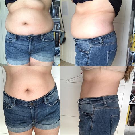 F/25/5’3” (162cm) [91.5kg/199.8lbs > 78kg/172lbs = 13.5kg/28lbs] Four ...