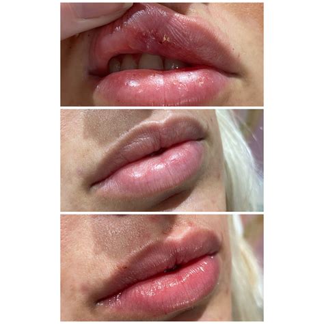 Appointments 3 — Radiant Med Spa | Let your true beauty SHINE