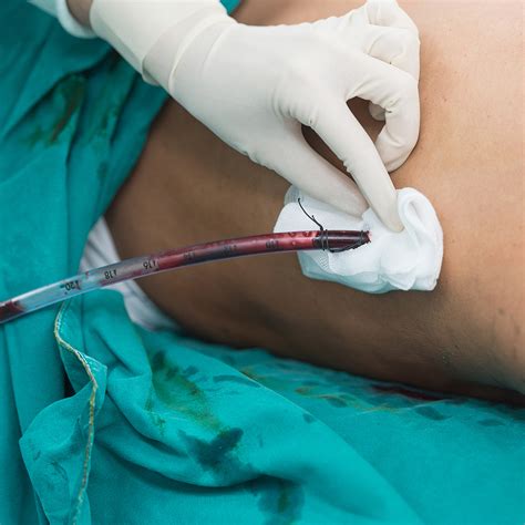 Inadequate Screening of Patient with Substance Use Disorder Has Fatal ...