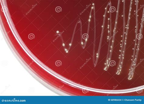 Bacteria Hemolysis Blood Agar at Isabel Kleeman blog