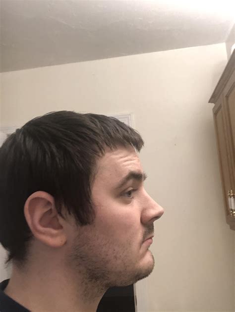 weak chin and lower jaw sag what should i do? : r/beards