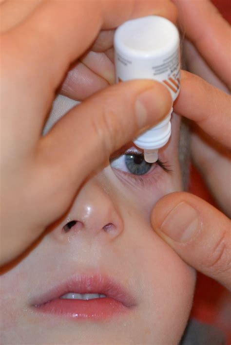 How to give eye drops to a young child or baby - Moms Budget