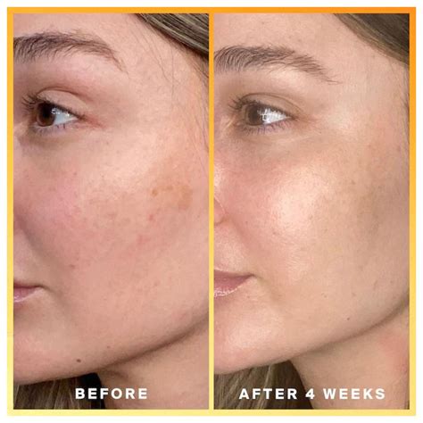 Daily Dose Vitamin C + SPF 40 Sunscreen Serum PA+ SUPERGOOP! | Make Import