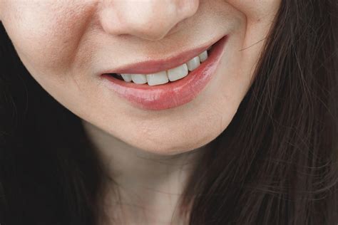 Calgary Perioral Dermatitis Relief: Find Natural Solutions with ...