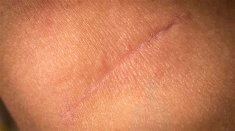 Dr. Michael Kaiser | Top Rated Neurosurgeon in New Jersey