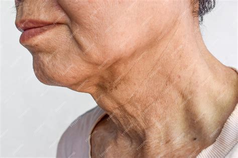 Premium Photo | Aging skin folds or skin creases or wrinkles at neck
