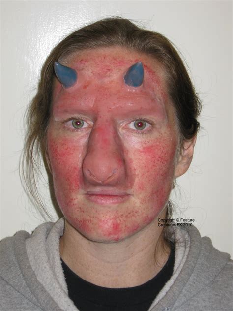 Flushed Skin Tone at Rachel Vance blog