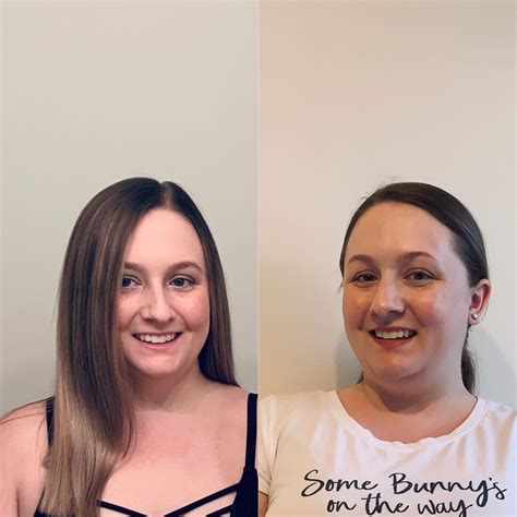 Pregnant Swollen Face