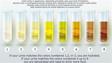 What Does Your Urine Look Like When Pregnant: A Guide – Home Improvement Way