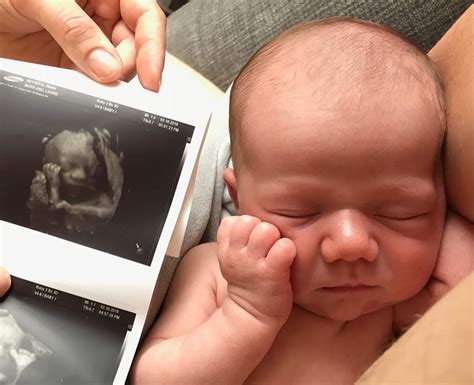 30 Weeks Pregnant 4d Ultrasound