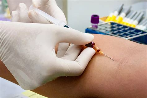 RDW Blood Test: Red Cell Distribution Width Test