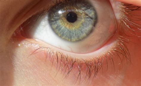 central heterochromia , the center of the eye is yellow/brown and the ...