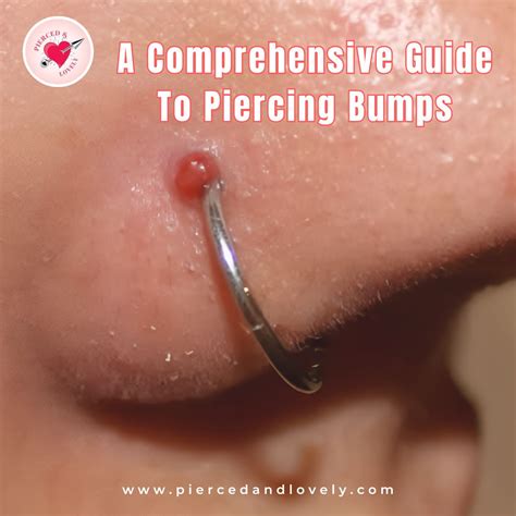 A Comprehensive Guide To Piercing Bumps – Pierced and Lovely