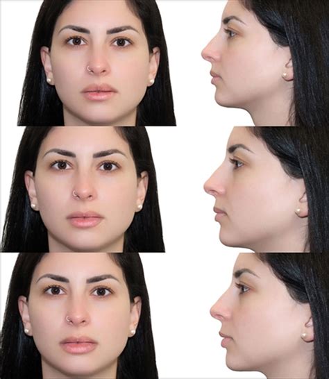 Why Is My Top Lip Smaller Than My Bottom Lip - Infoupdate.org