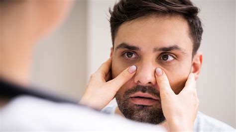 How Much Does Sinus Surgery Cost? Are There Alternatives? - GoodRx