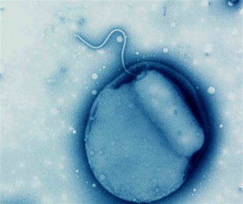 Newly discovered species of bacteria linked to gum disease, cystic fibrosis and antimicrobial ...