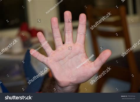 Six Fingers On Hand Stock Photo 775727416 | Shutterstock
