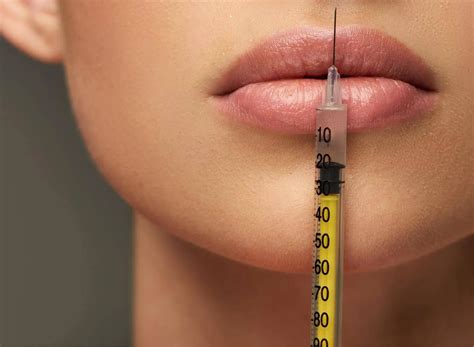 Non Cancerous Lesions Skin – Benign Growth on Skin | rtwskin