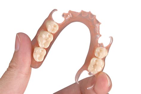 Success with Removable Partial Denture | Modern Dental Pacific